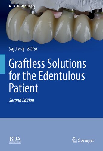 Graftless Solutions for the Edentulous Patient (BDJ Clinician’s Guides)