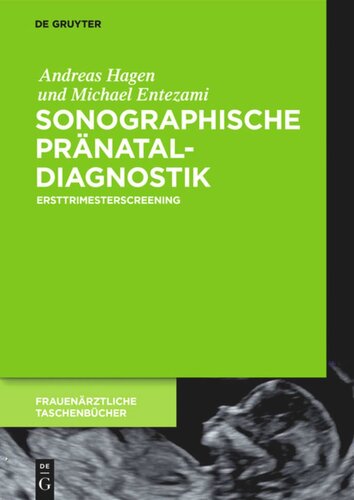 Sonographische Pränataldiagnostik: Ersttrimesterscreening