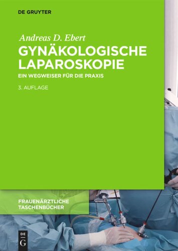 Gynäkologische Laparoskopie: Ein Wegweiser für die Praxis mit Hinweisen für das ambulante Operieren und die Roboter-Chirurgie