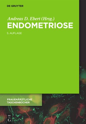 Endometriose: Ein Wegweiser für die Praxis