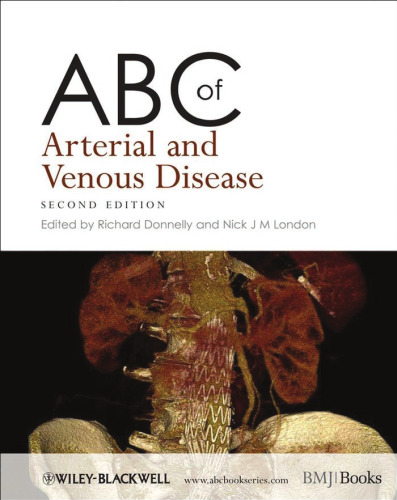 ABC of Arterial and Venous Disease 