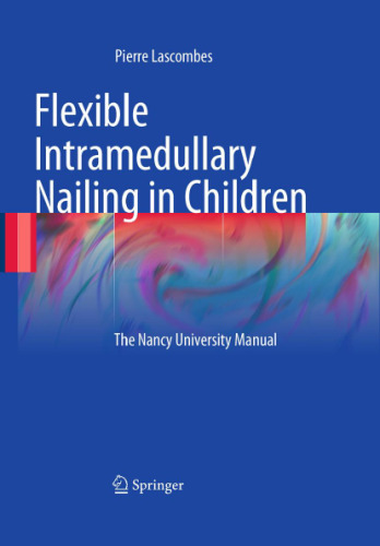 Flexible Intramedullary Nailing in Children: The Nancy University Manual