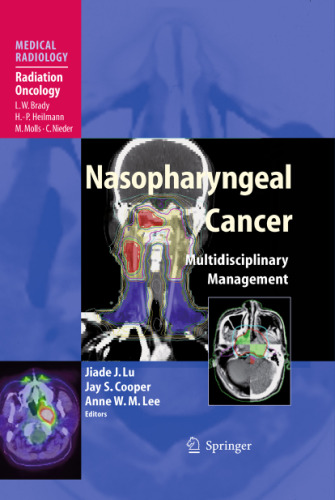 Nasopharyngeal Cancer: Multidisciplinary Management