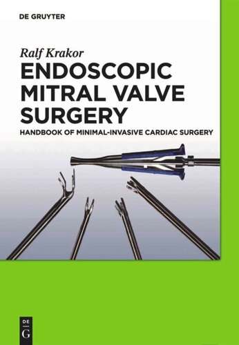 Endoscopic Mitral Valve Surgery: Handbook of Minimal-invasive Cardiac Surgery