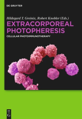 Extracorporeal Photopheresis: Cellular Photoimmunotherapy