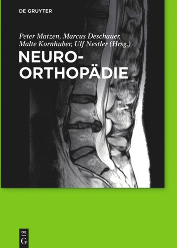 Neuroorthopädie