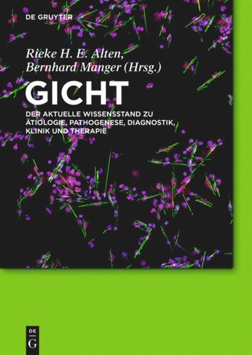 Gicht: Der aktuelle Wissensstand zu Ätiologie, Pathogenese, Diagnostik, Klinik und Therapie