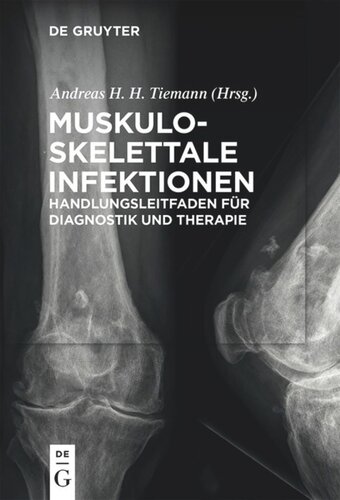 Muskuloskelettale Infektionen: Handlungsleitfaden für Diagnostik und Therapie