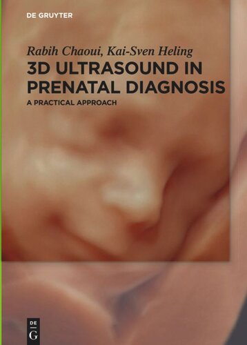 3D Ultrasound in Prenatal Diagnosis: A Practical Approach