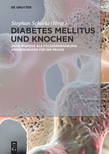 Diabetes Mellitus und Knochen: Osteoporose als Folgeerkrankung: Konsequenzen für die Praxis
