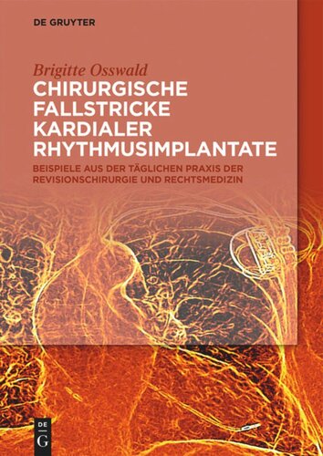 Chirurgische Fallstricke kardialer Rhythmusimplantate: Beispiele aus der täglichen Praxis der Revisionschirurgie und Rechtsmedizin