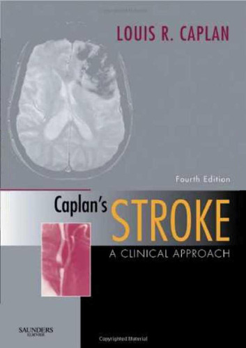 Caplan's Stroke: A Clinical Approach