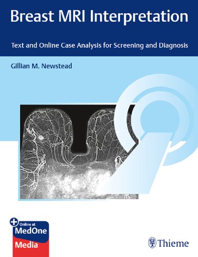 Breast MRI Interpretation Text and Case Analysis for Screening and Diagnosis