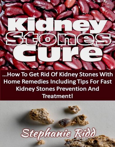 Kidney Stones Cure: How to Get Rid Of Kidney Stones with Home Remedies Including the Tips for Kidney Stones Prevention and Treatment!