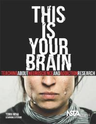 This Is Your Brain : Teaching about Neuroscience and Addiction Research