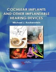 Cochlear Implants and Other Implantable Hearing Devices