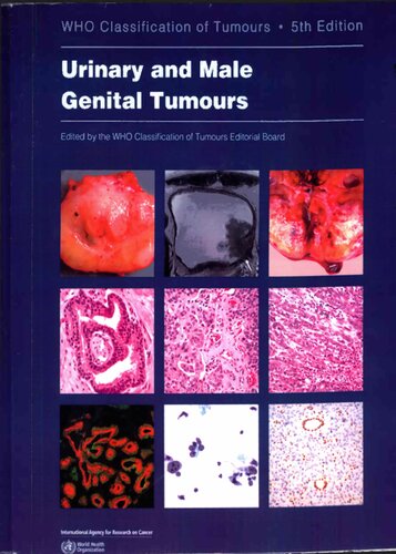 WHO Classification of Urinary and Male Genital Tumours