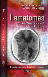 Hematomas: Types, Treatments and Health Risks : Types, Treatments and Health Risks