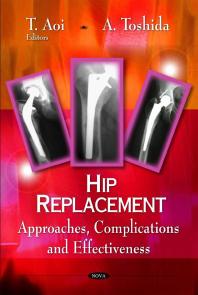 Hip Replacement : Approaches, Complications and Effectiveness
