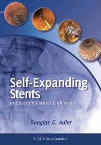 Self-Expanding Stents in Gastroenterology