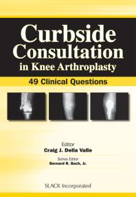 Curbside Consultation in Knee Arthroplasty : 49 Clinical Questions