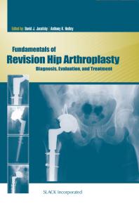 Fundamentals of Revision Hip Arthroplasty : Diagnosis, Evaluation, and Treatment