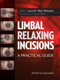 Limbal Relaxing Incisions : A Practical Guide