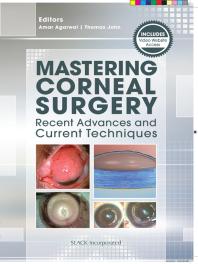 Mastering Corneal Surgery : Recent Advances and Current Techniques