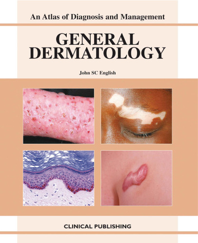 General Dermatology: An Atlas of Investigation and Management