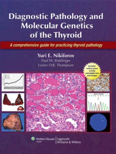 Diagnostic Pathology and Molecular Genetics of the Thyroid: A Comprehensive Guide for Practicing Thyroid Pathology