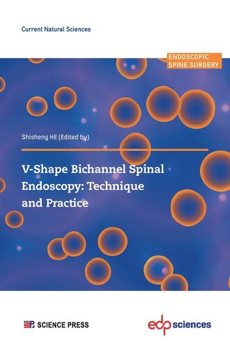 V-Shape Bichannel Spinal Endoscopy: Technique and Practice