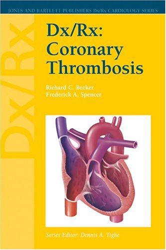 Dx/Rx Coronary Thrombosis