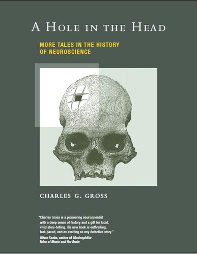 A Hole in the Head: More Tales in the History of Neuroscience
