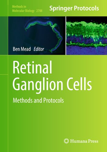 Retinal Ganglion Cells: Methods and Protocols (Methods in Molecular Biology, 2708)