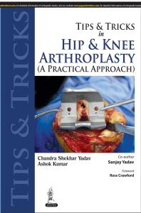 Tips and Tricks in Hip and Knee Arthroplasty