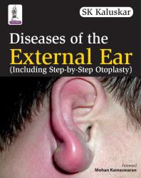 Diseases of the External Ear (Including Step-By-Step Otoplasty)