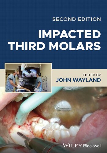 Impacted Third Molars [Team-IRA]
