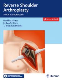 Reverse Shoulder Arthroplasty : A Practical Approach