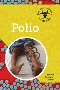 Polio