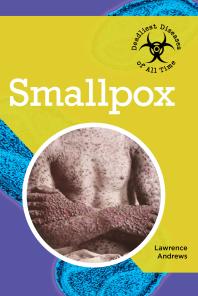 Smallpox