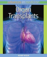Organ Transplants