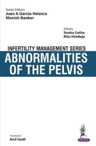 Infertility Management Series: Abnormalities of the Pelvis