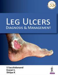 Leg Ulcers: Diagnosis and Management
