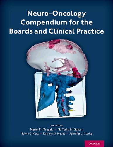 Neuro-Oncology Compendium for the Boards and Clinical Practice [Team-IRA] (True PDF)