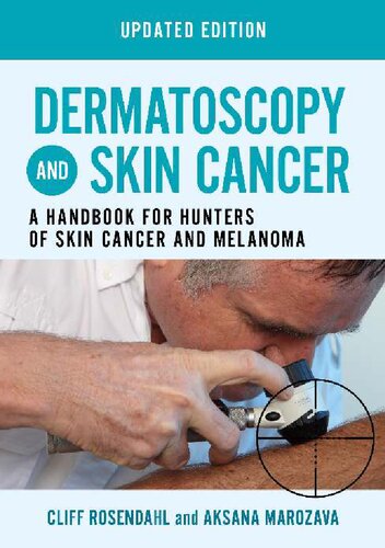 Dermatoscopy and Skin Cancer, updated edition: A handbook for hunters of skin cancer and melanoma [Team-IRA]
