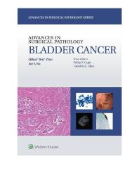 Advances in Surgical Pathology: Bladder Cancer