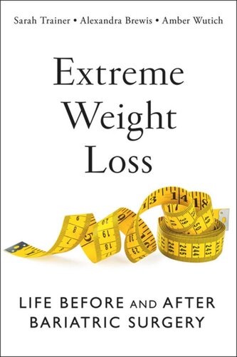 Extreme Weight Loss: Life Before and After Bariatric Surgery