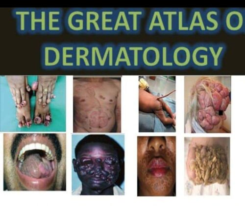 E3 great atlas of dermatology indexe