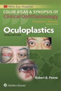 Oculoplastics: Oculoplastics