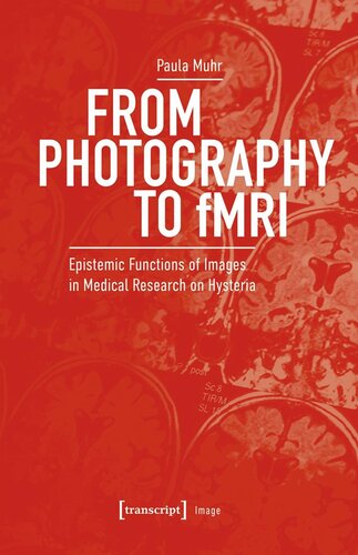 From Photography to fMRI: Epistemic Functions of Images in Medical Research on Hysteria